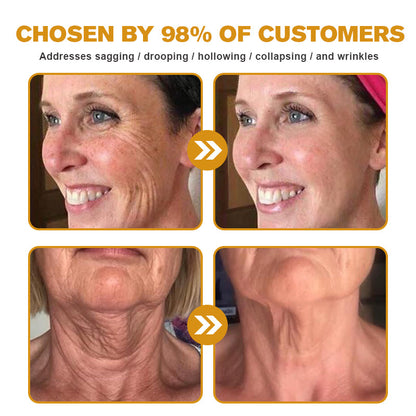 Crema para eliminar arrugas con veneno de abeja y botox